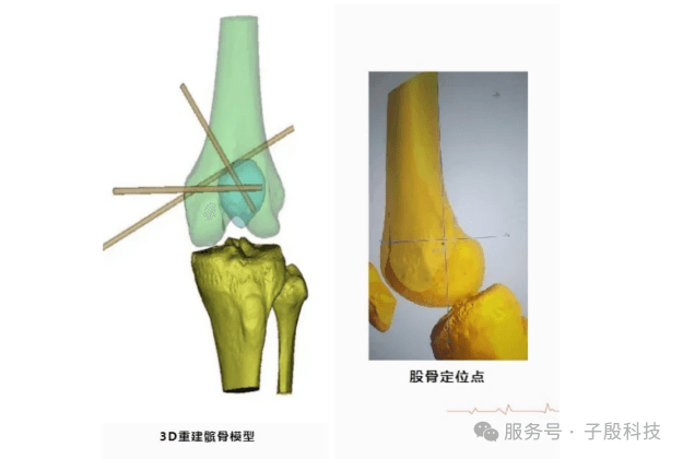 3D重建模型