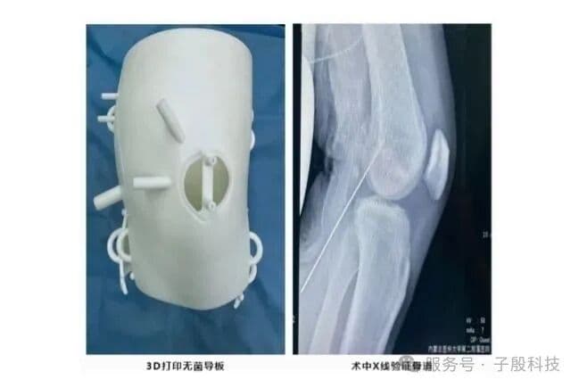 导板定位